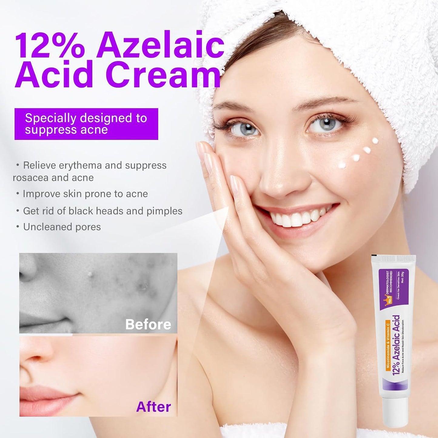 Azelaic Acid Gel, Cosmetics / Skincare / Personal Care