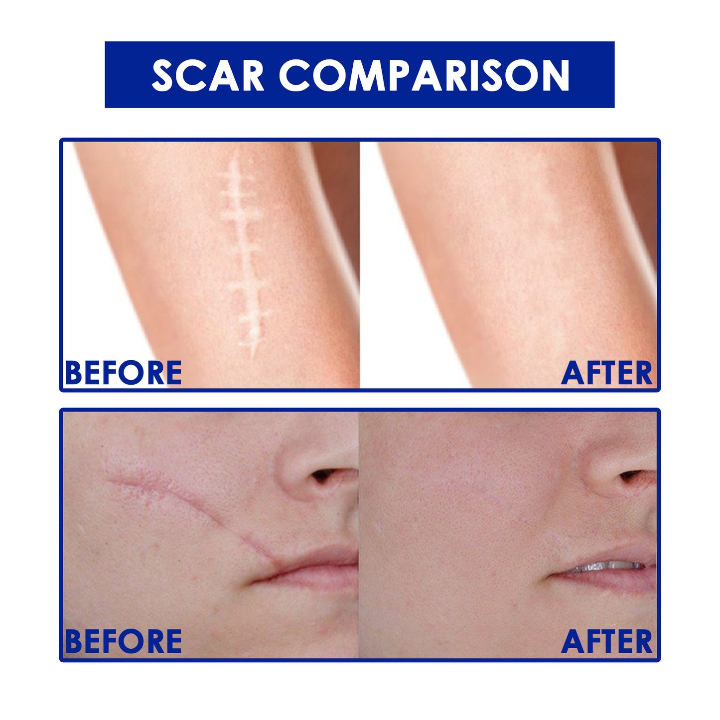 Skin Care Gel Skin Concave And Convex Wound